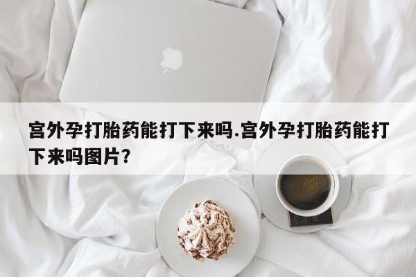 怀孕个月能不能用打胎药要闻 第60页